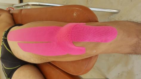 Exemples de bandes de taping sur la jambe Exemples de bandes de taping sur la jambe