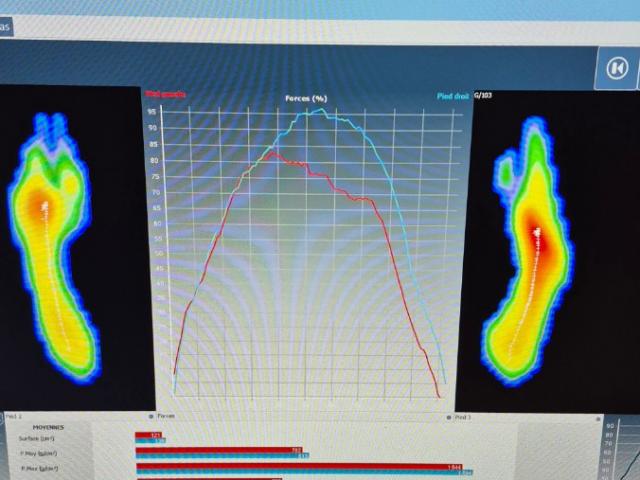 Objectiver l'invisible grâce à un bilan complet et une analyse dynamique objetive